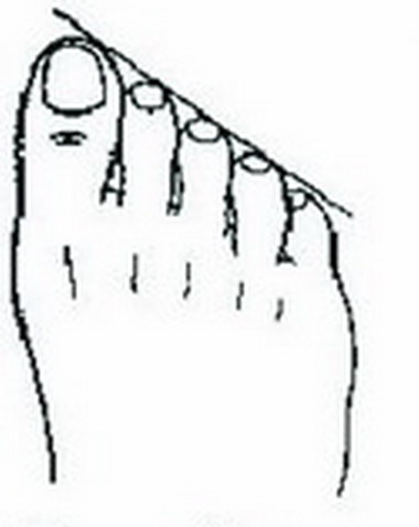 你是哪种脚型？