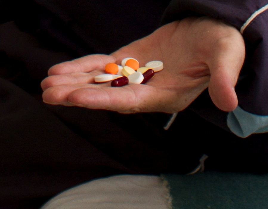 仰光省患有抗药性肺结核病患者多多 （华轩）