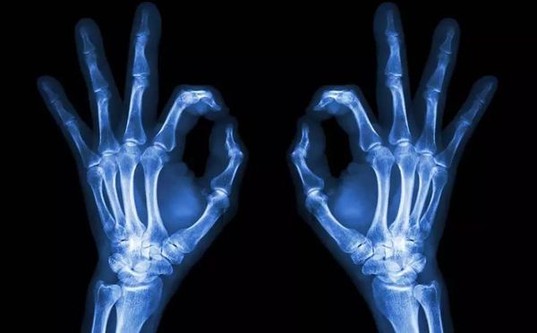 CT、核磁与B超的区别，讲的太到位了！