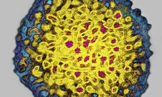 仰光、曼德勒、内比都三地 丙型肝炎患者可免费接受治疗