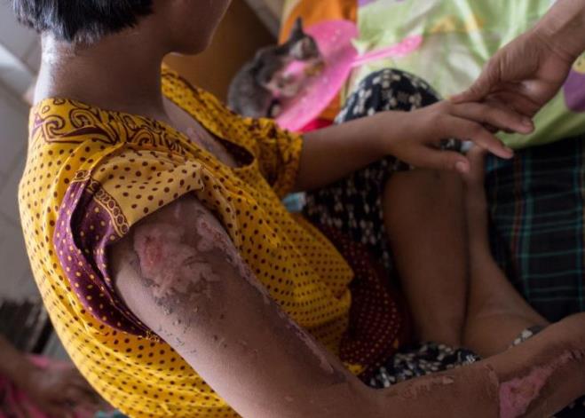 童佣受虐事件渐曝光 确立保护法令进度迟缓