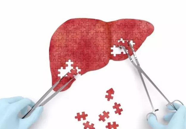 曼德勒医院首次成功完成肝移植