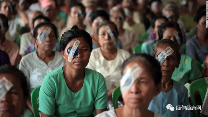 新护眼计划免费治疗300位白内障患者