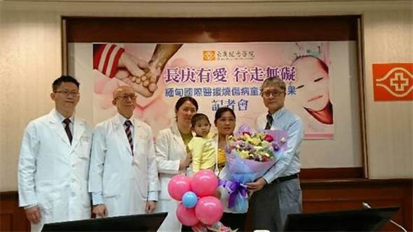 跨海来台求医重生 缅甸烧伤女童明返国