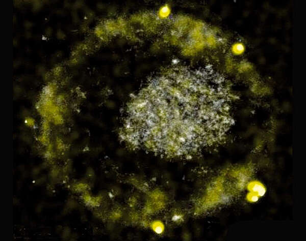 科学家发现会吐“金块”的细菌