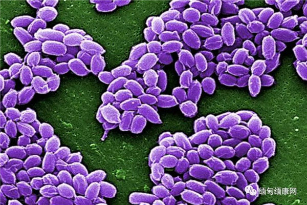 网传美提拉镇奶牛感染炭疽病 政府辟谣