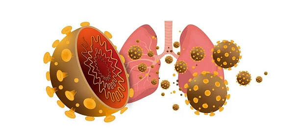 除了肺部，新冠病毒还可能攻击哪些器官？
