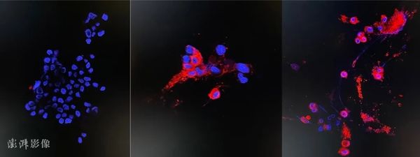 德国专家称奥密克戎是“圣诞礼物” 或加速终结疫情