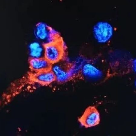 英国首现奥密克戎死亡病例