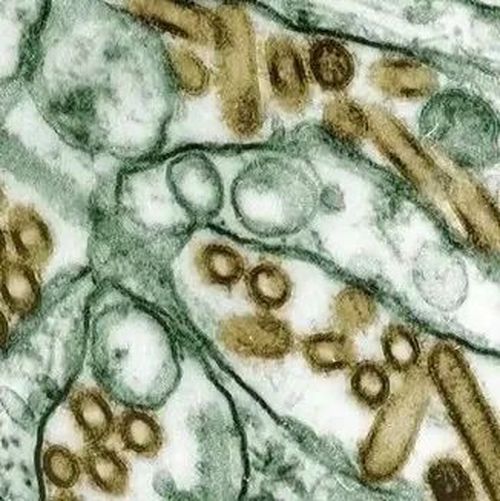 紧急删除！ 美国在怕什么？