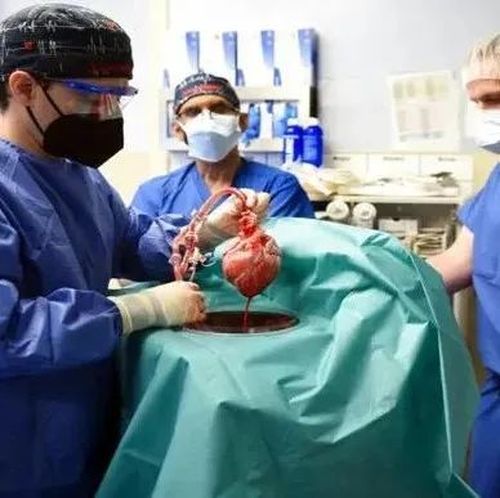全球首例移植猪心脏者死因初探：心脏携带动物病毒