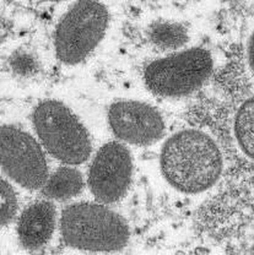 这场新疫情在美国有失控风险！