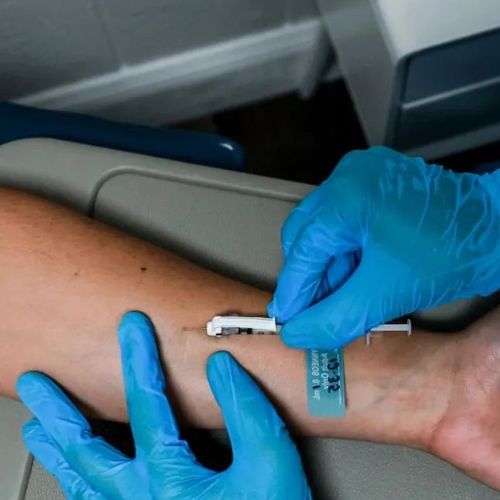 美媒：猴痘病毒传播途径或被搞错