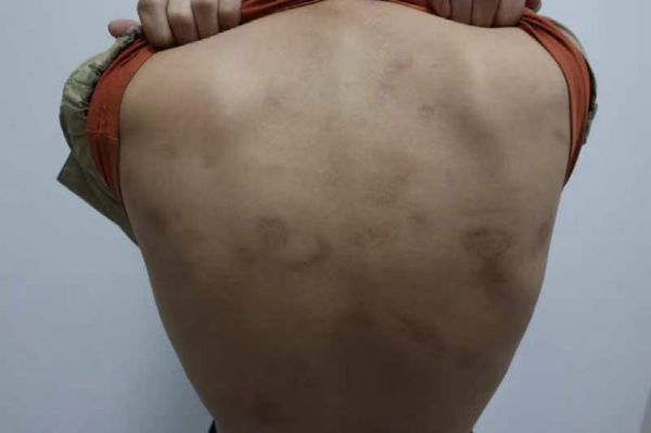 回国自首人员讲述在缅“电诈噩梦”