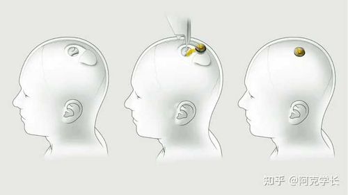 饱受争议！美国还是批准了……