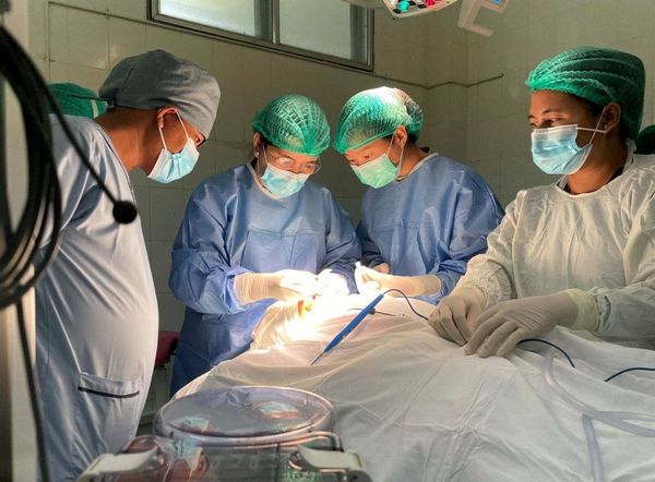 唇腭裂患者可联系仰光和曼德勒8家人民医院进行手术